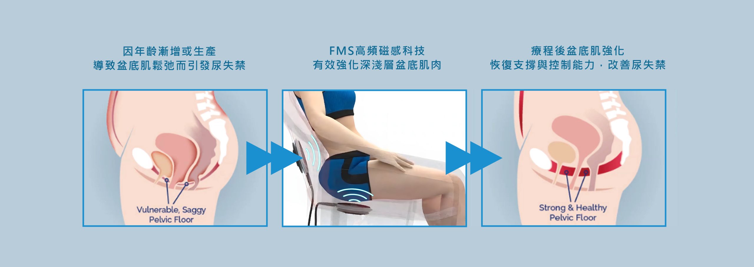 寵愛椅作用原理